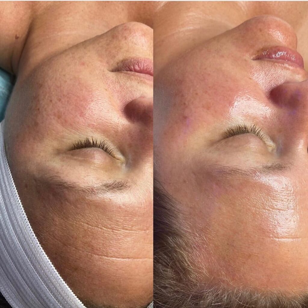 Instagram post from maisondesthetique_ch. This post is in position 2.