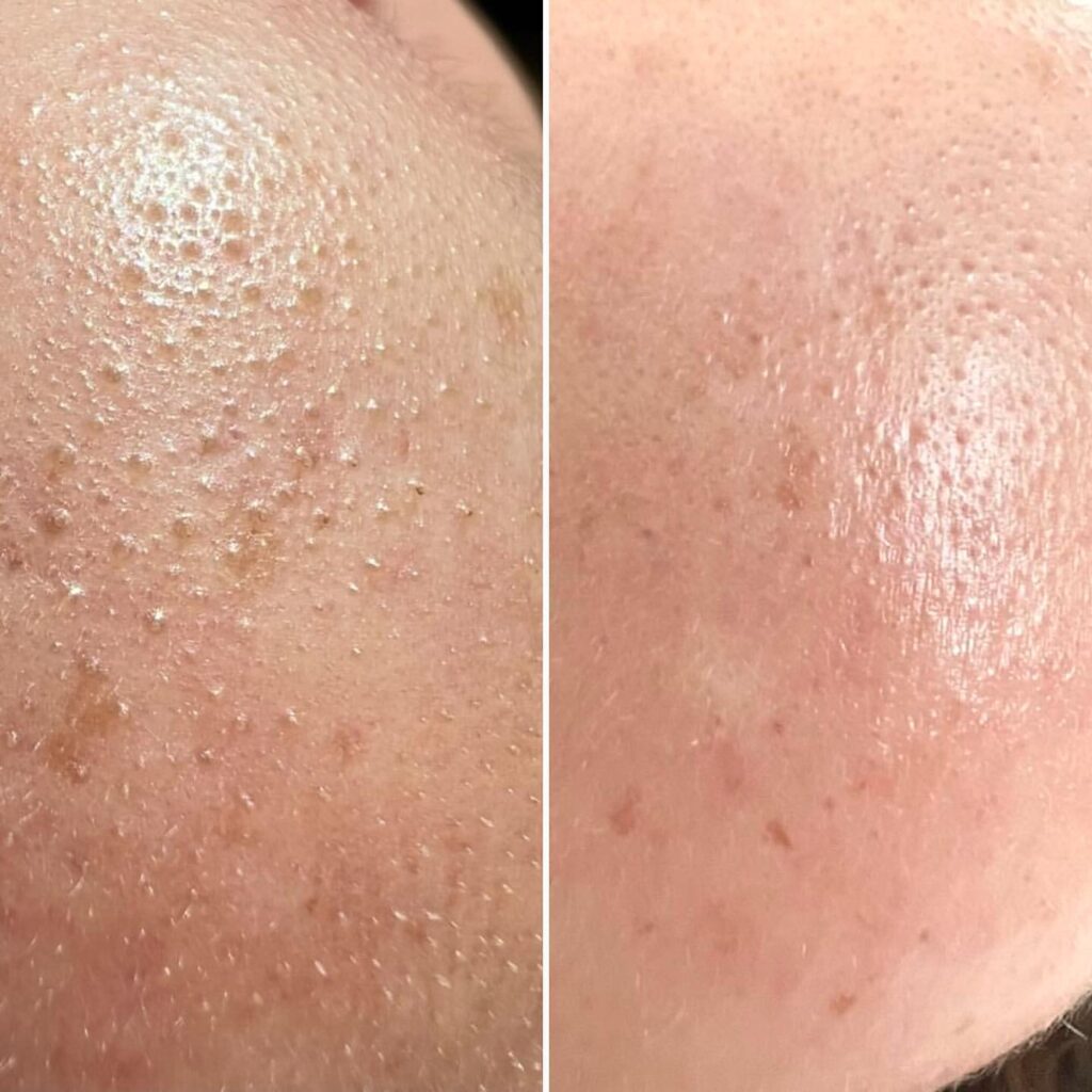 Instagram post from maisondesthetique_ch. This post is in position 3.